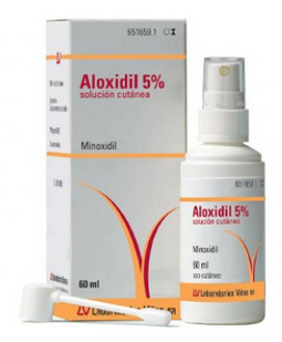 calvície tratada com aloxidil